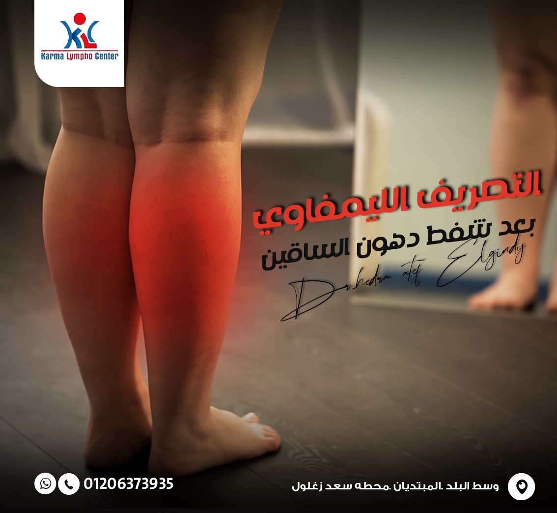 مركز الكرمه لعلاج مرض الفيل
