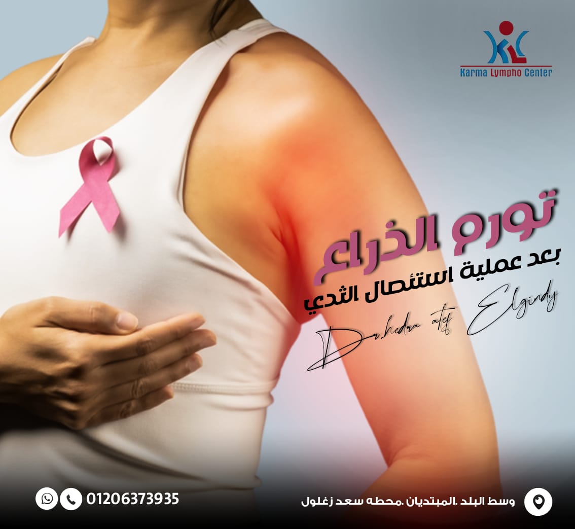 مركز الكرمه لعلاج مرض الفيل