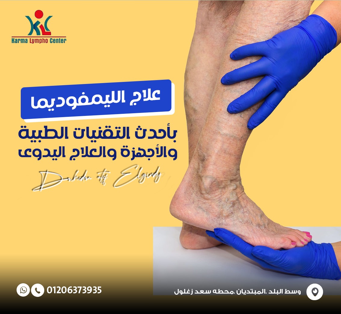 مركز الكرمه لعلاج مرض الفيل