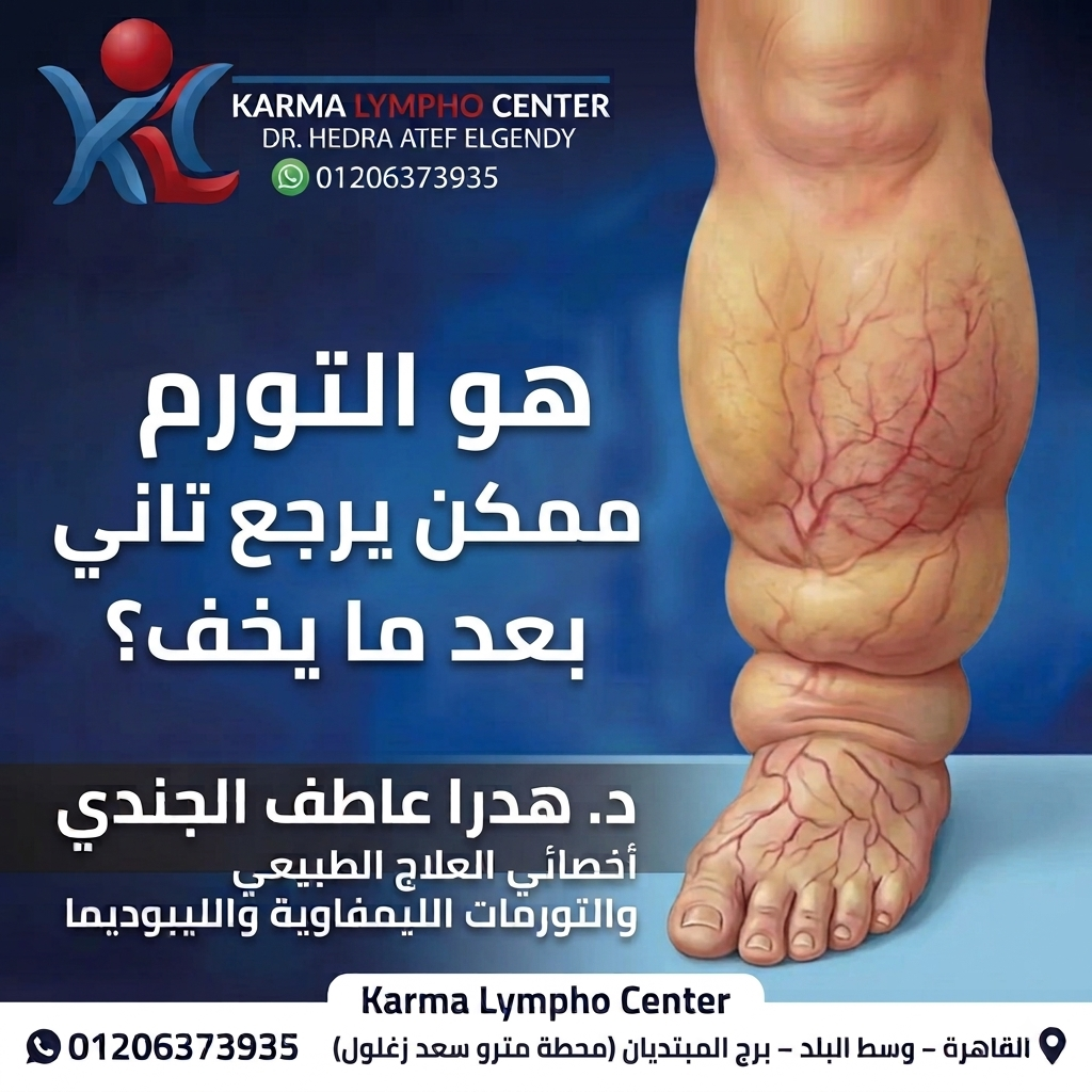 مركز الكرمه لعلاج مرض الفيل