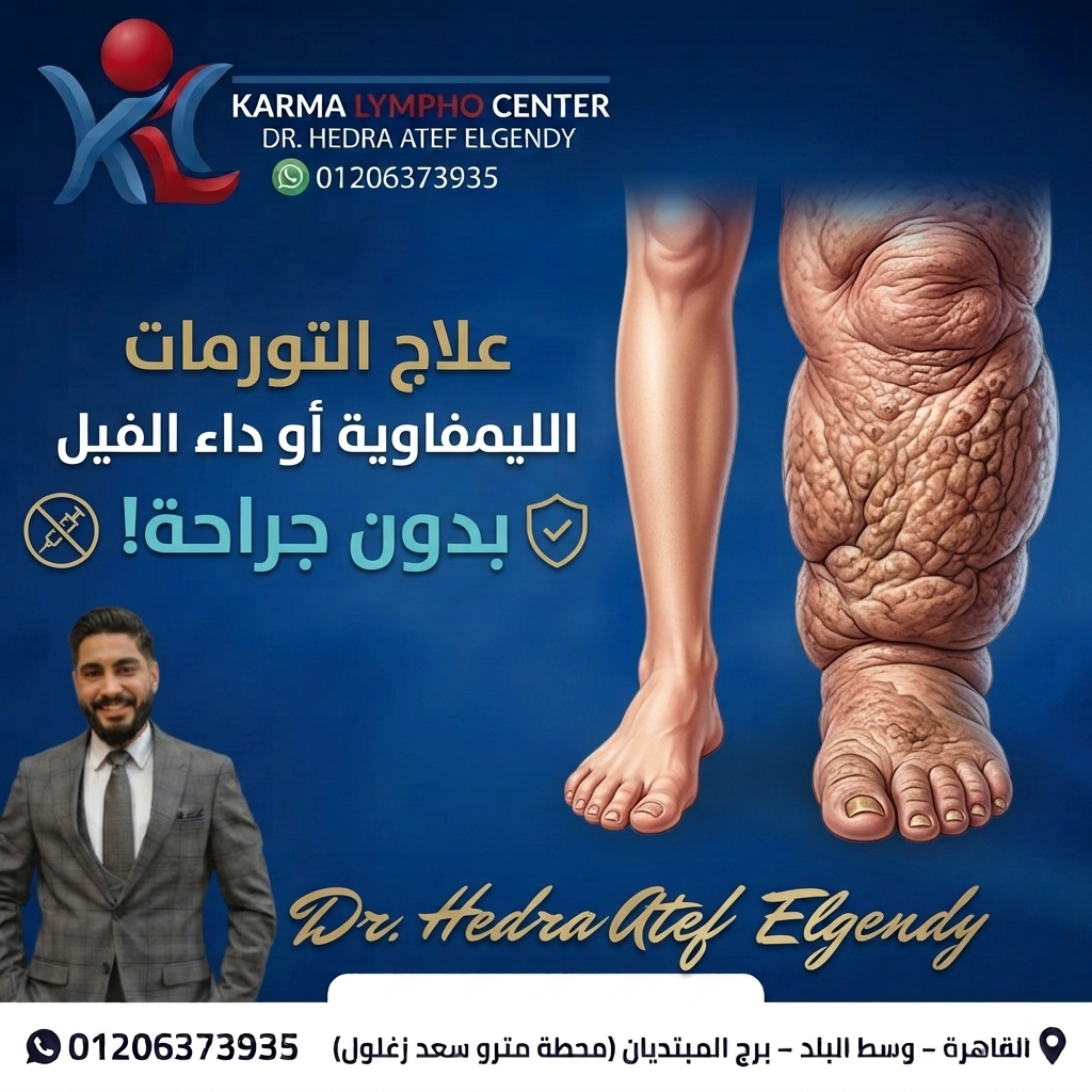 مركز الكرمه لعلاج مرض الفيل