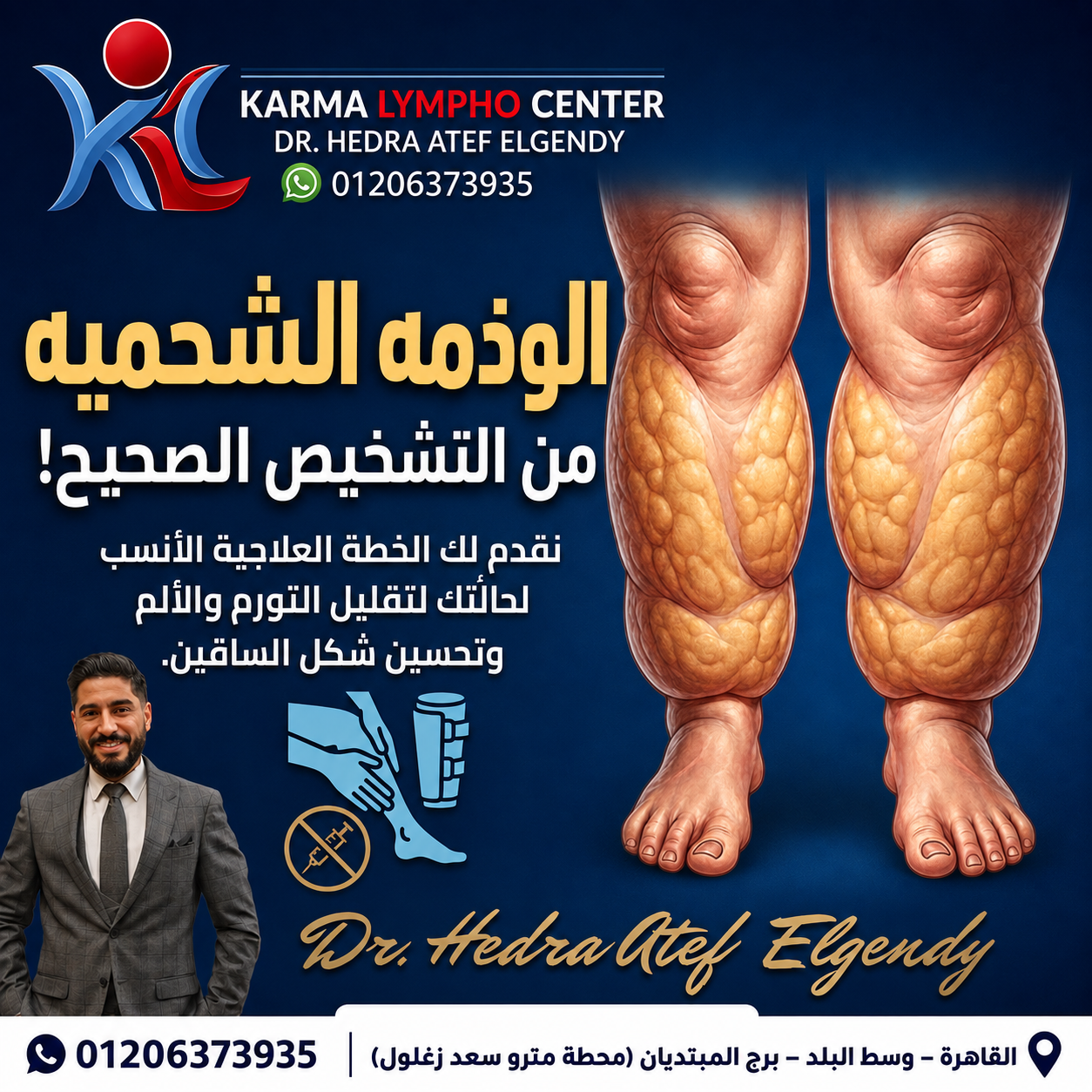 مركز الكرمه لعلاج مرض الفيل