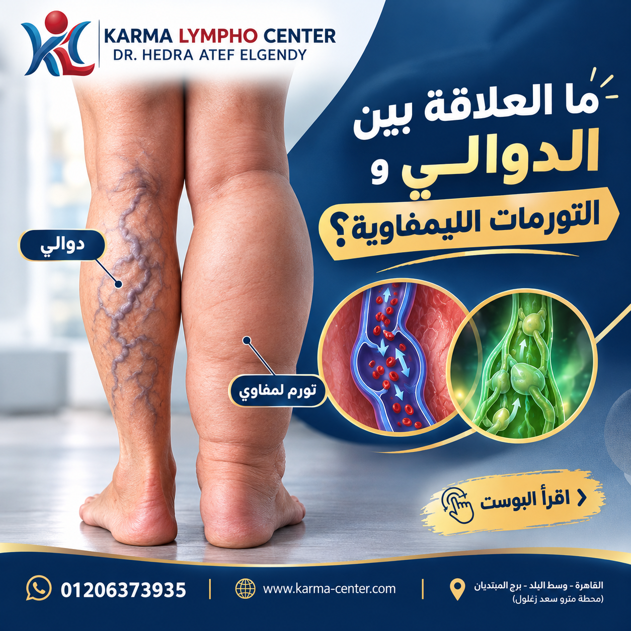 مركز الكرمه لعلاج مرض الفيل